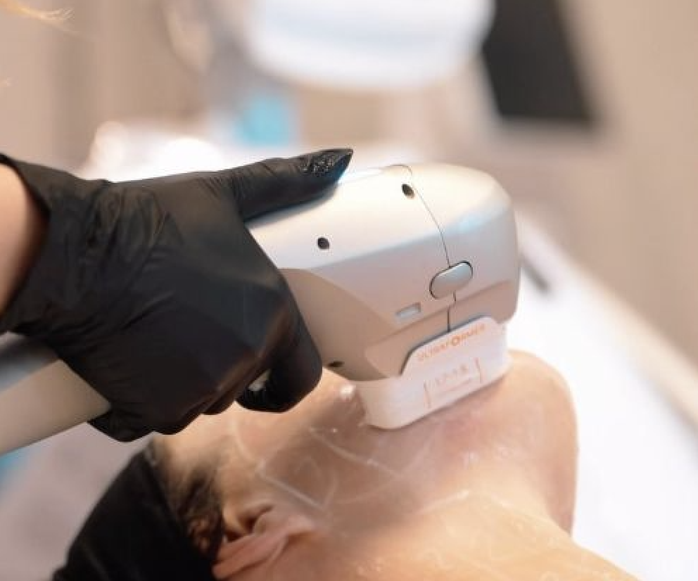 HIFU-behandling hos Golden Beauty i Oslo